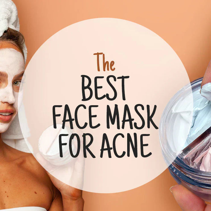 The Best Face Mask for Acne