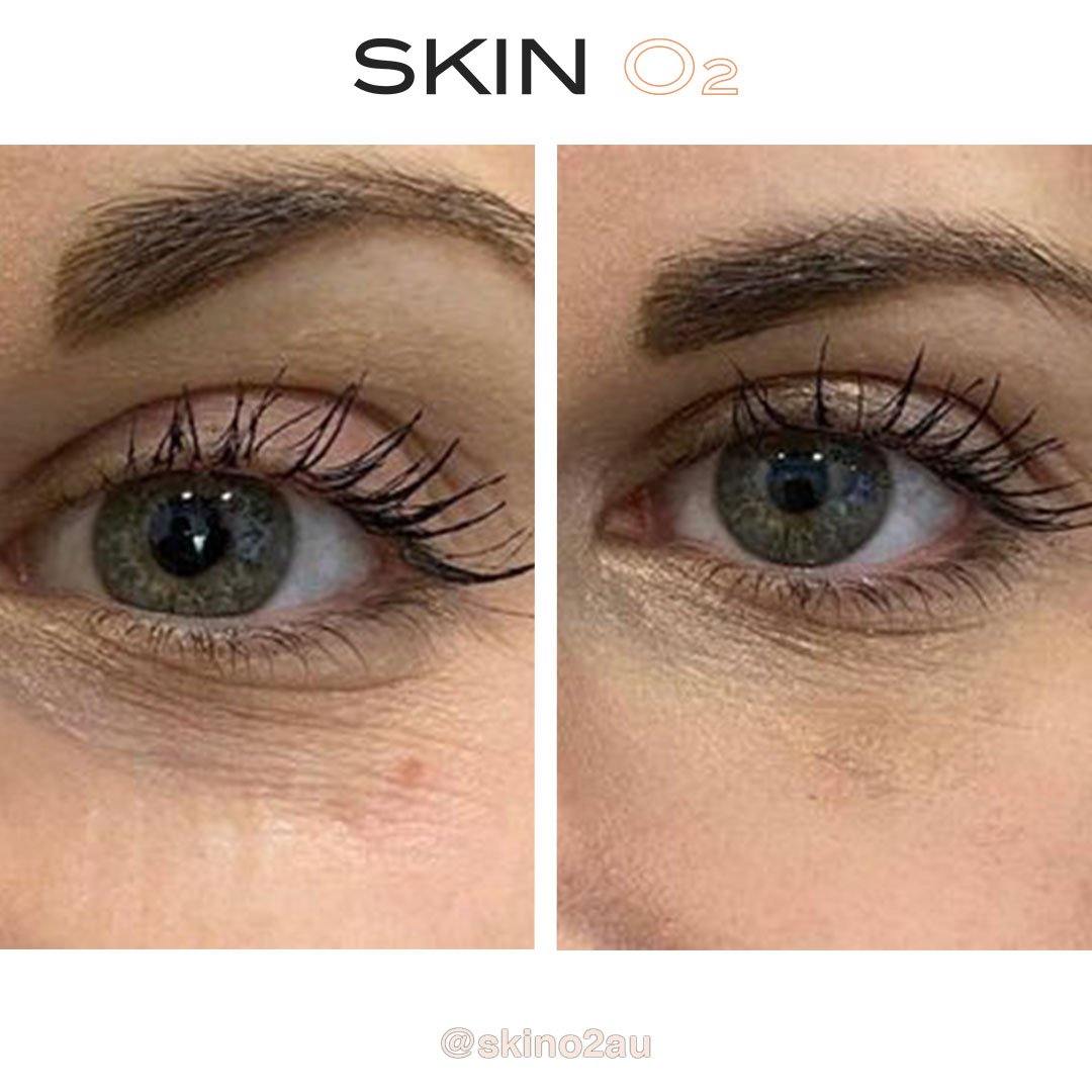 Peptide Eye Cream + Platinum Eyelift - Skin O2
