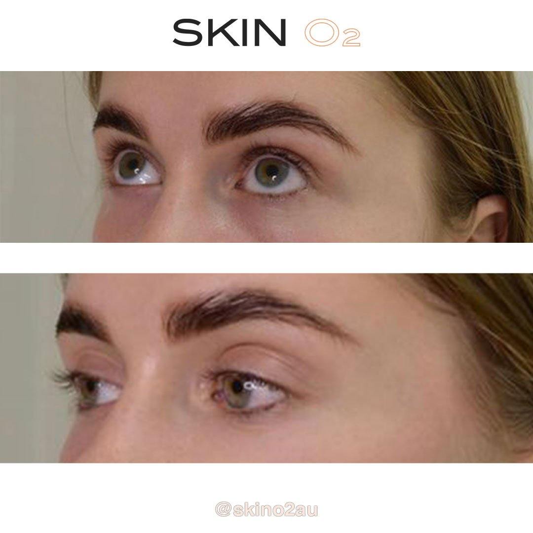 Peptide Eye Cream + Platinum Eyelift - Skin O2