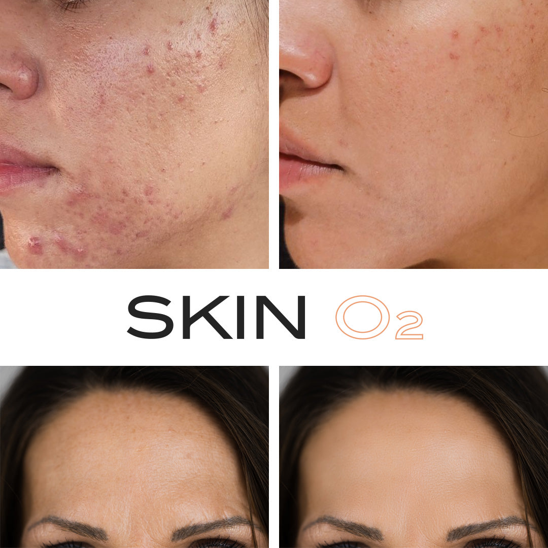 مصل الريتينول الفوليرين