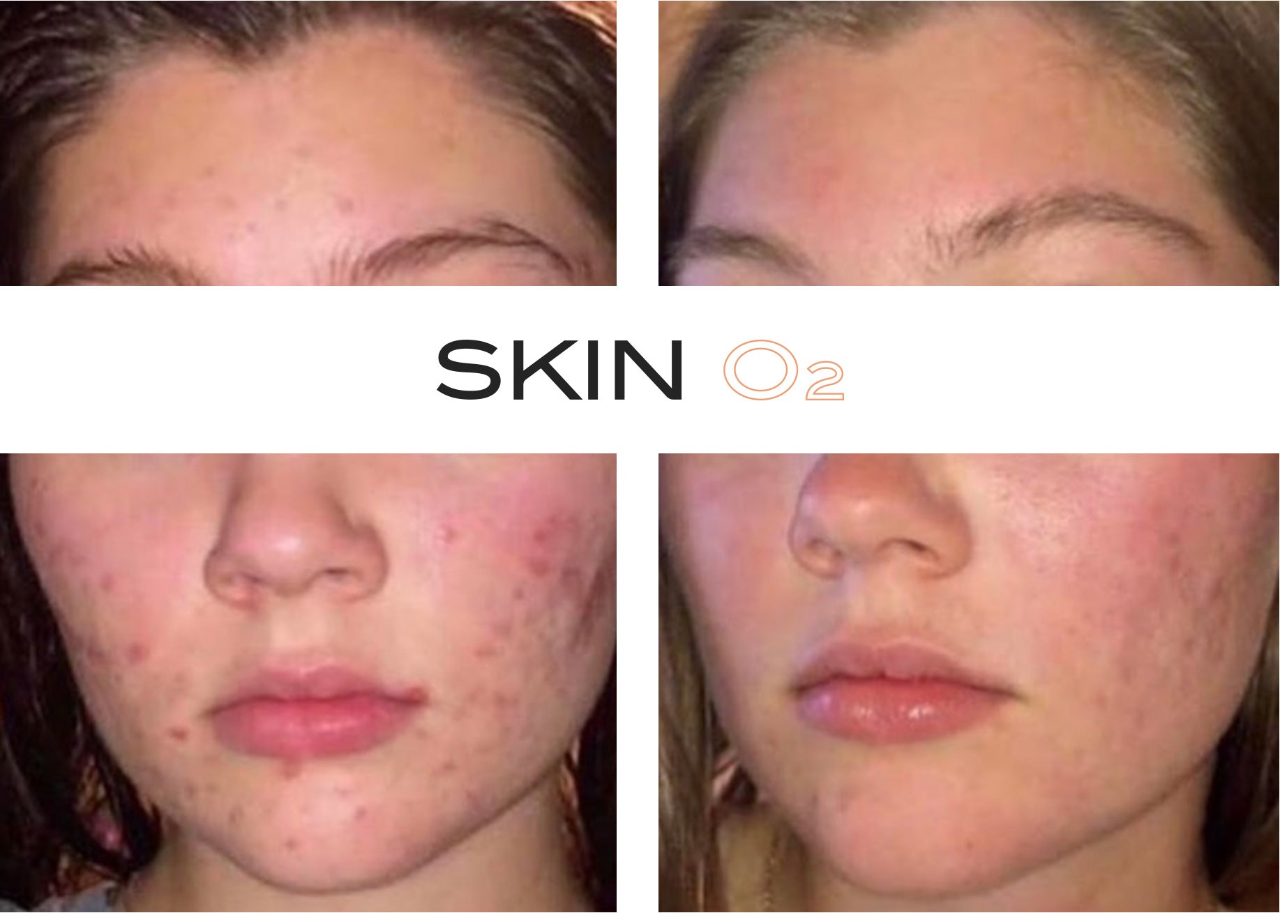 مصل الريتينول الفوليرين